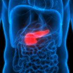 It’s Never Too Late: Colorectal cancer awareness