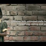 This film on cleft lips will tug at your heartstrings