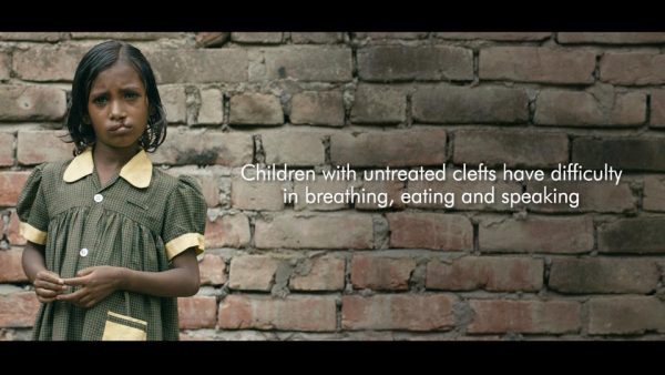 This film on cleft lips will tug at your heartstrings